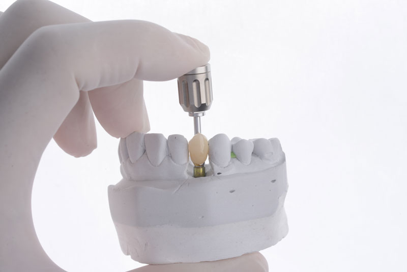 a single dental implant with a tool to place it into the jaw