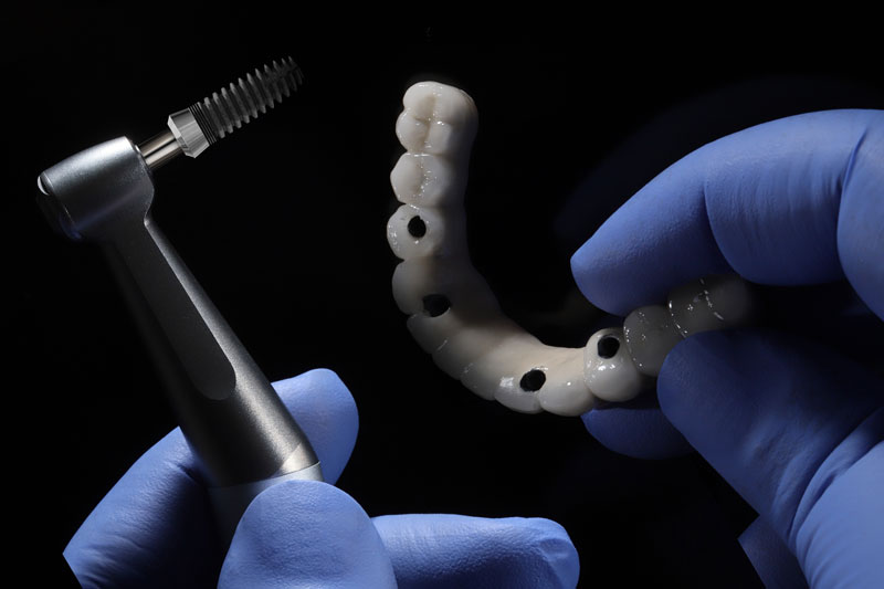 a full arch of teeth with 4 holes for dental implants to be placed on the arch