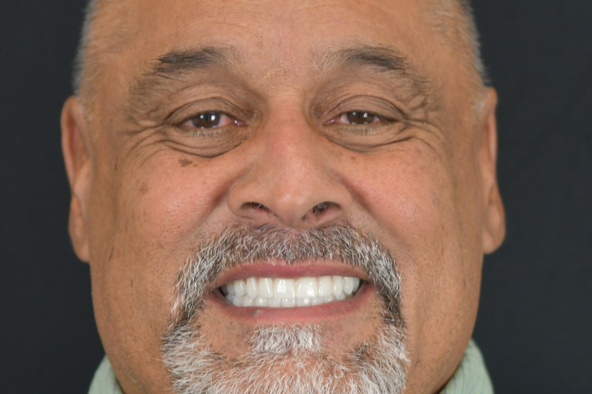 Restore patient after dental implant treatment