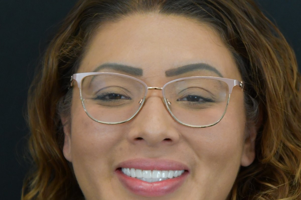 Restore patient after dental implant treatment