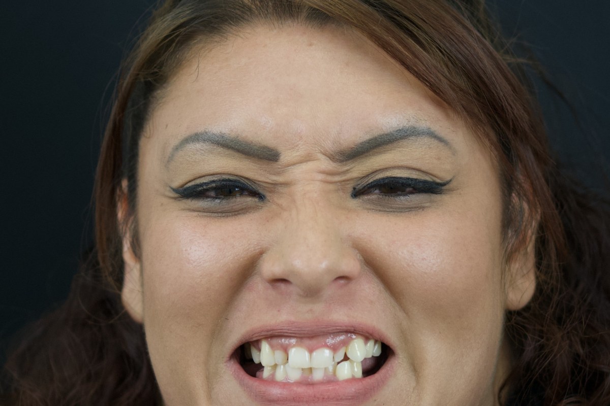 Restore patient before dental implant treatment