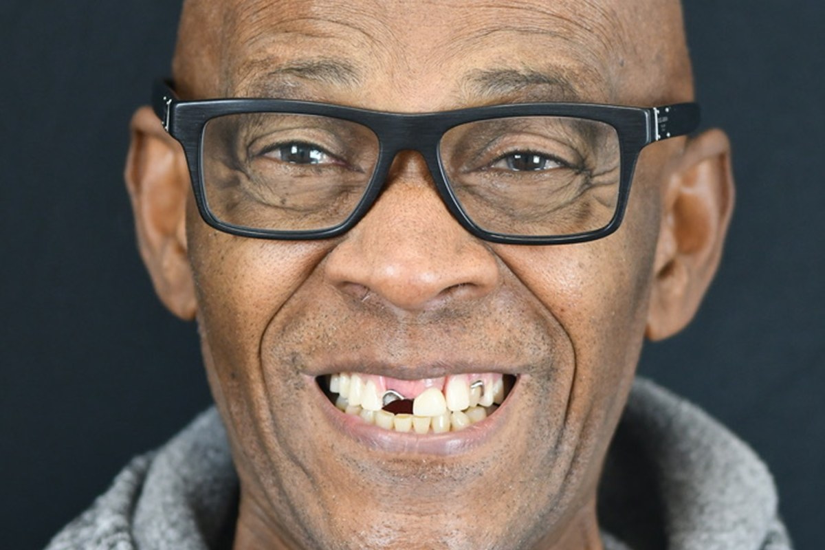 Restore patient before dental implant treatment