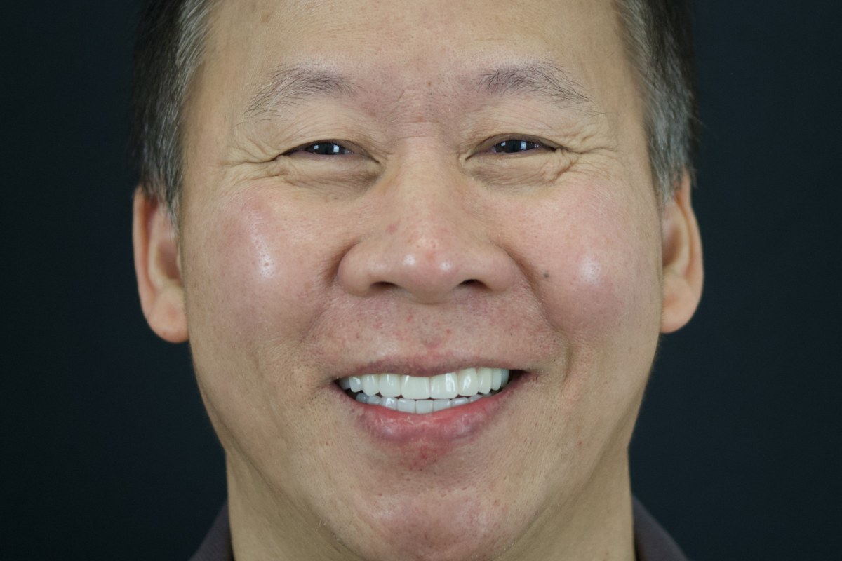 Restore patient after dental implant treatment