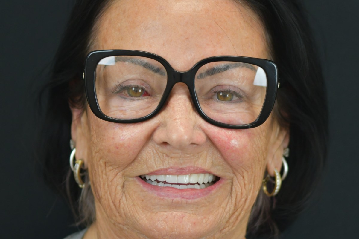 Restore patient after dental implant treatment